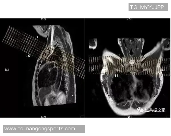 约维奇重摔受伤退场X光检查结果无异常明日将进行MRI检查评估伤情